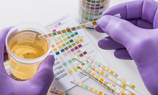 Evaluaciones toxicológicas